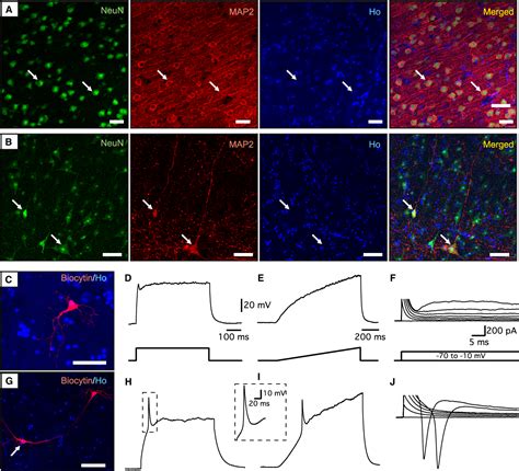 Figure 1 From Oligodendrocytes In Human Induced Pluripotent Stem Cell