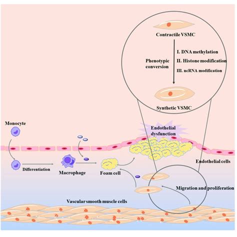 Vascular Smooth Muscle Cell Phenotypic Conversion In Atherosclerosis