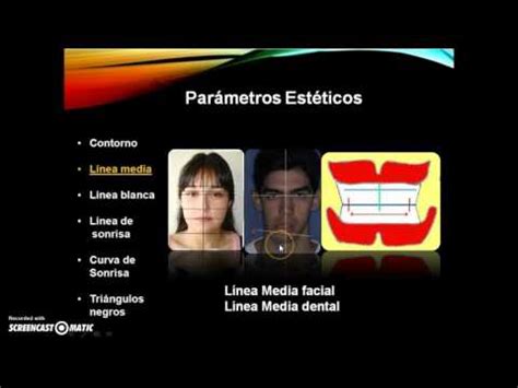 Parametros Est Ticos En Dentaduras Totales Youtube