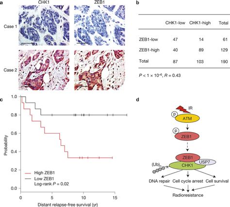 Zeb1 Correlates With Chk1 Protein Levels And Poor Clinical Outcome In