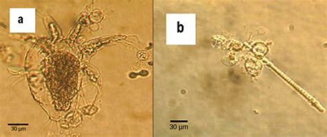 Chytridiomycota Los Quítridos Biología Para Mayores Ii Virtual World