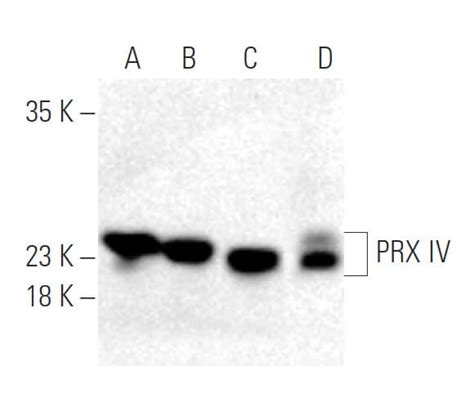 Anti PRX IV Antibody F 2 SCBT Santa Cruz Biotechnology