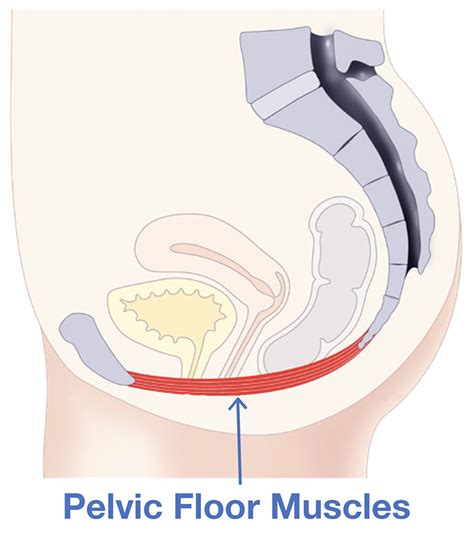 Emsella Chair Pelvic Floor Therapy Chichester Chiropractor