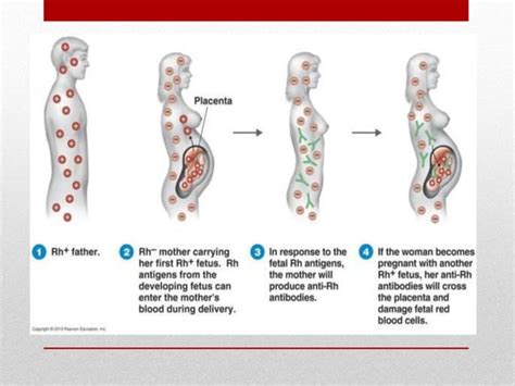 Blood disorders ppt | PPT