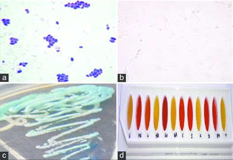 Mycological Investigation Of Candida Dubliniensis A Grampositive