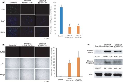 ZDHHC11promoted Cell Growth And Inhibited Apoptosis In Colorectal