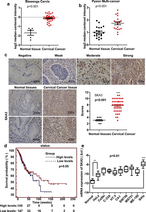 Expression Of Ska3 Is Higher In Cc Tissue And Appears To Be Correlated