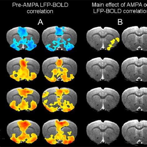 Effects Of Vta Ampa Microinjection On Striatal Lfp Signal A Download Scientific Diagram