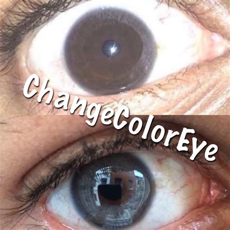 Laser Eye Color Change Uk Allright Weblog Stills Gallery