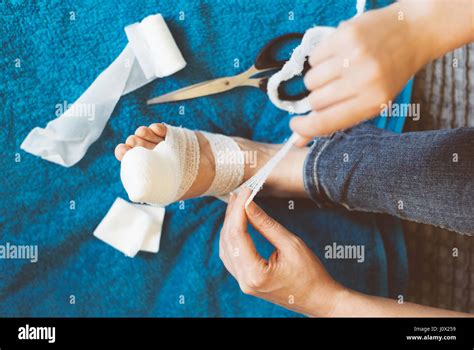 Woman Bandaging Her Injured Leg On Sofa At Home Stock Photo Alamy