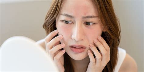 Homeopathy Treatment Of Skin Allergies Afecto Homeopathy