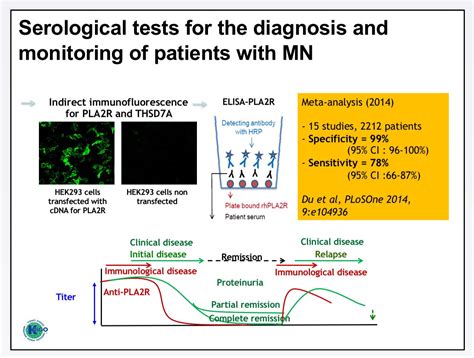 Edgar V Lerma 🇵🇭 On Twitter Membranous Nephropathy Discovery Of Pla2r And Thsd7a Has Led To