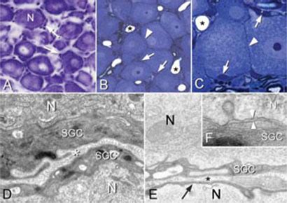 Satellite Glial Cells In The Trigeminal Ganglion As A Determinant Of