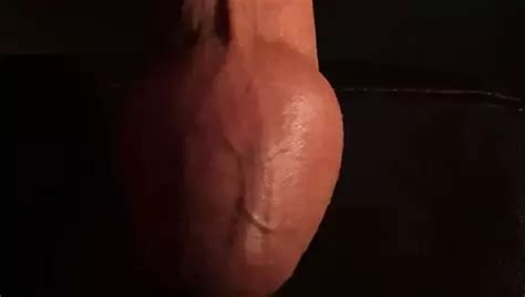 Free Foreskin Inflation Gay Porn Videos Xhamster