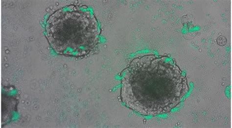 Scientists engineer bacteria to detect cancer DNA | Technology News - The Indian Express