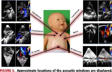 Virtual Neonatal Echocardiographic Training System VNETS An