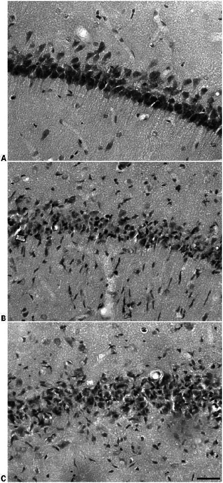 Photomicrographs (406 ) of the hippocampal CA1 region of male rats with ... 