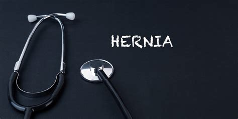 Spigelian Hernia Symptoms, Causes, Treatment