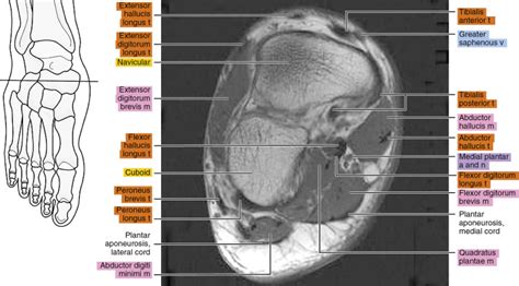 Foot Muscles Mri Anatomy Mri Ankle Anatomy Ankle Anatomy Anatomy Hot ...