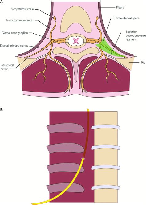 Paravertebral Space Anatomy