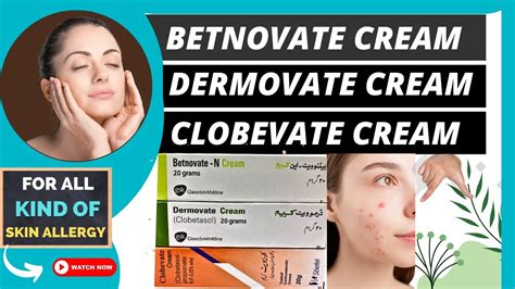 Betnovate Clobevate And Dermovate Creams Which One Is Right For Hands