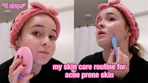 My Skincare Routine For Acne Prone Skin 8 Steps Youtube