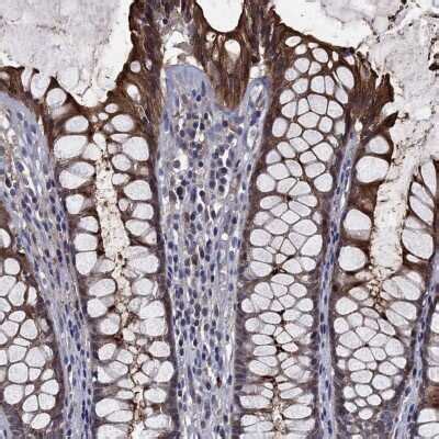 CEACAM7 Antibody NBP3 17026 Novus Biologicals