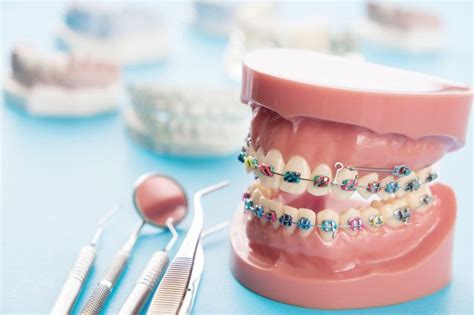 Descarga Más Fotos De Stock Premium En Freepik Orthodontics