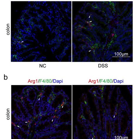 M1 macrophage polarization was promoted, and M2 macrophage polarization ...