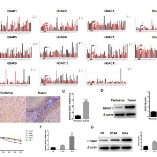 HDAC1 is highly expressed in the CC tumor tissue. A: Expression of ... 