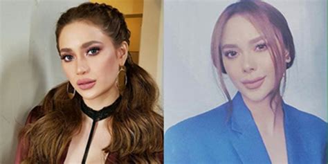 5 Artists Who Admitted To Have Undergone Plastic Surgery News Info Ph