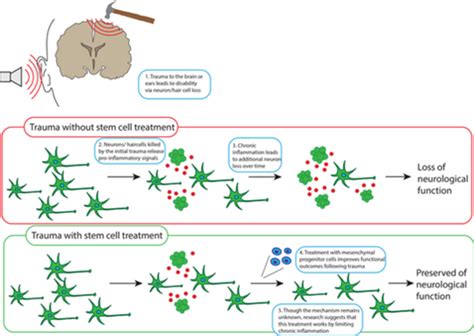 Adult Stem Cell Therapy and the Immune Response | Stem Cells Portal