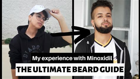 How To Grow A Beard Ftm Tips Minoxidil Guide Youtube