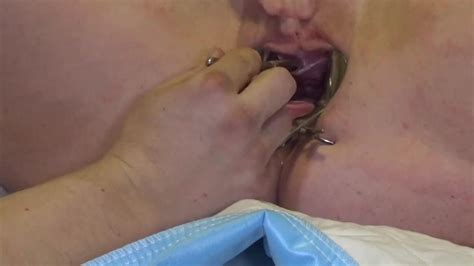 Analslut Filled With Her Own Piss In Speculum Gaping Pussy Urethra Stretc ThisVid