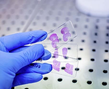 Know All About Histopathology Biopsy