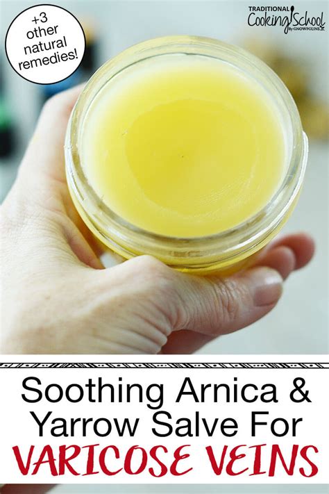 Varicose Veins Treatment Soothing Arnica And Yarrow Salve