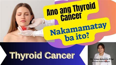 Ano Ang Thyroid Cancer Nakamamatay Ba Ito Youtube