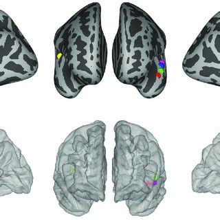 Locations Of The Ieeg Electrodes Used For Human Electrophysiology