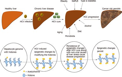 Risk Of Hepatocellular Carcinoma After Hepatitis C Virus Cure