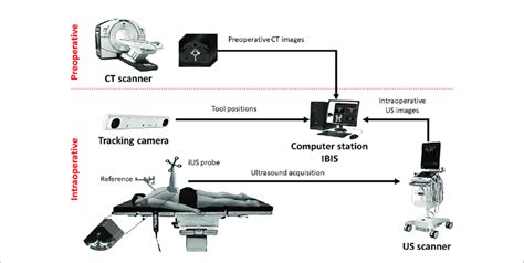 Setup Of The Ultrasound Based Image Guided Neurosurgery System Download Scientific Diagram