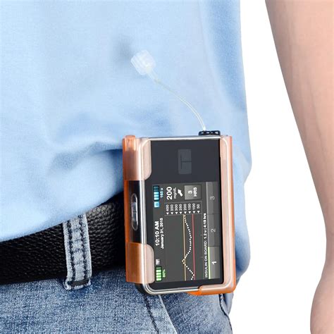 Amazon Iguerburn Rotating Case For Tandem Tslim X Insulin