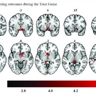 | Bilateral activation in the ventral striatum as a function of ...