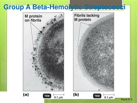 Ppt Bacterial And Viral Skin And Soft Tissue Infections Powerpoint Presentation Id 9347047