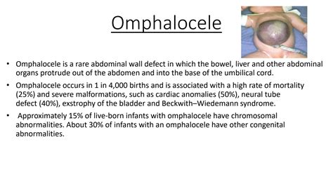 SOLUTION Ompehelocele Omphalitis Umbilical Hernia Studypool