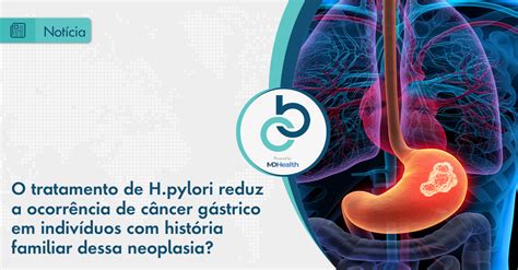 O Tratamento De H Pylori Reduz A Ocorrência De Câncer Gástrico Em