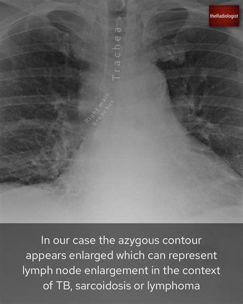 Theradiologist On Twitter Case Explanation