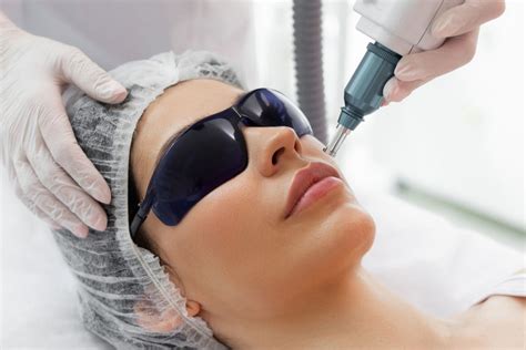 Laser Skin Treatments Skinpen Microneedling Orangetwist