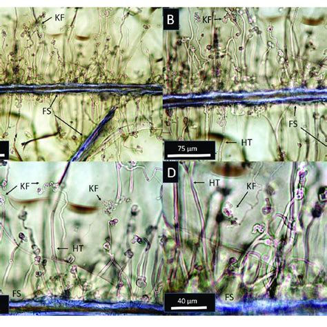 Transmitted Light Photomicrographs At Increasing Magnification From