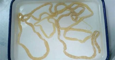 Anatomy Of A Tapeworm