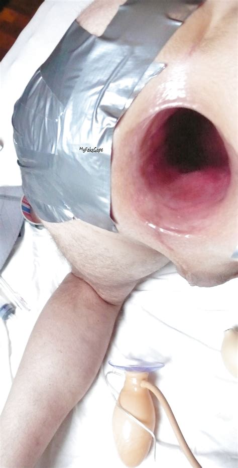 My Fake Gape Porn Pictures Xxx Photos Sex Images Pictoa